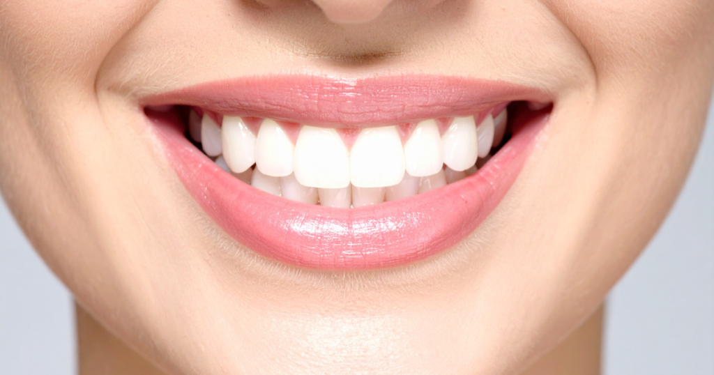 Smile implant treatment